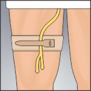 Urocare 6311 - Foley Cath Fabric Strap, Catheter Holder Arm 14", ea