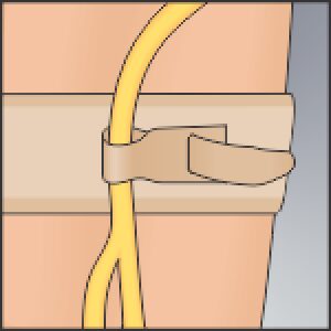 Urocare 6313 - Catheter/Drainage Tube Abdominal Strap, EA